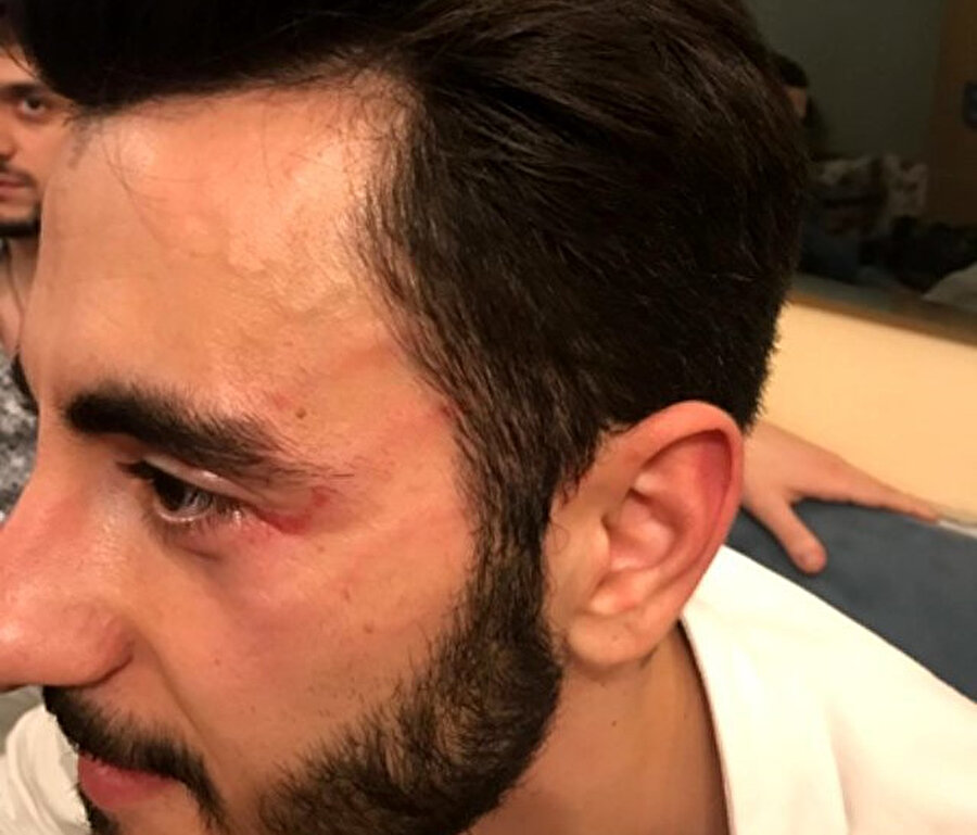 Reynmen'in darp ettiği muhabir Akif Yaman