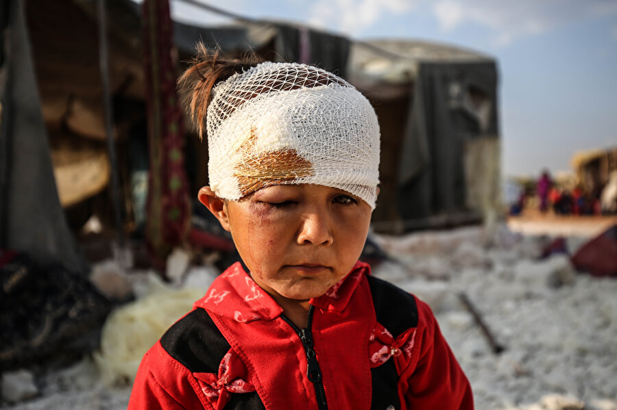 Suriye'de Rusya'ya ait savaş uçaklarının, İdlib Gerginliği Azaltma Bölgesi'ndeki bir çadır kampına düzenlediği hava saldırısında bir çocuk yaşamını yitirdi, 3 sivil yaralandı.