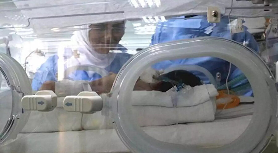 Mide ve bağırsakları dışarıda doğan bebek başarılı bir operasyonla sağlığına kavuşturuldu.