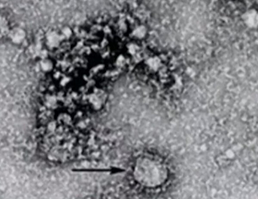 Çin'deki virüsün mikroskopla çekilen görüntüsü 