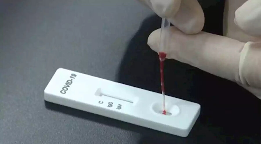15 dakikada sonuç veren tanı kitleri
