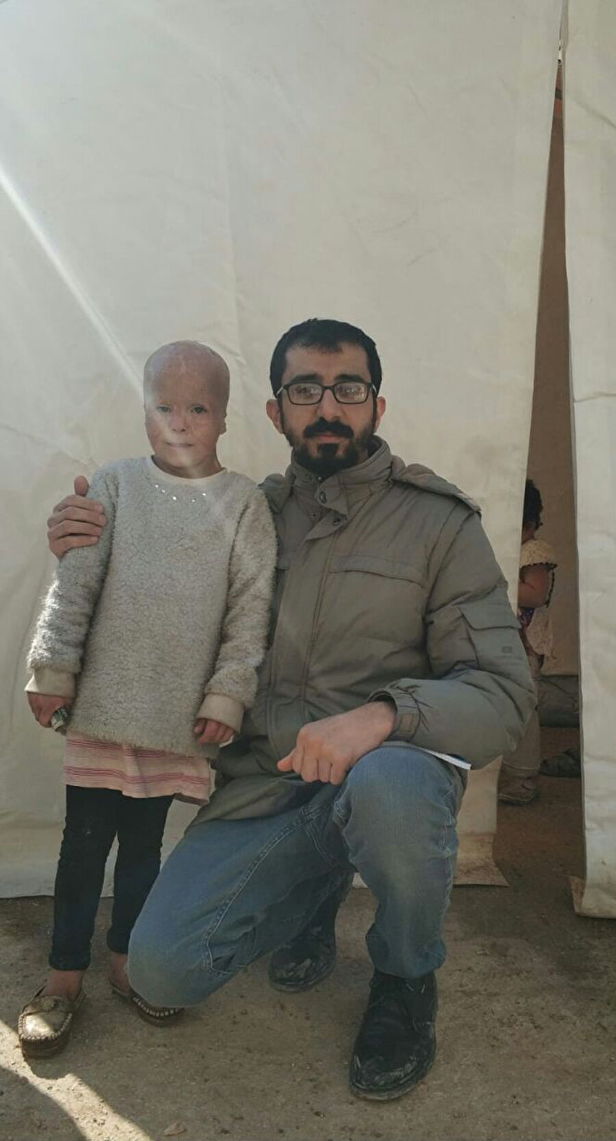 Fosfor bombası minik Kevser’i bu hale getirmiş.