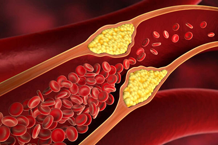 Kolesterol, hayvanların vücut dokularındaki hücre zarlarında bulunan ve kan plazmasında taşınan bir sterol, yani bir steroid ve alkol birleşimidir.