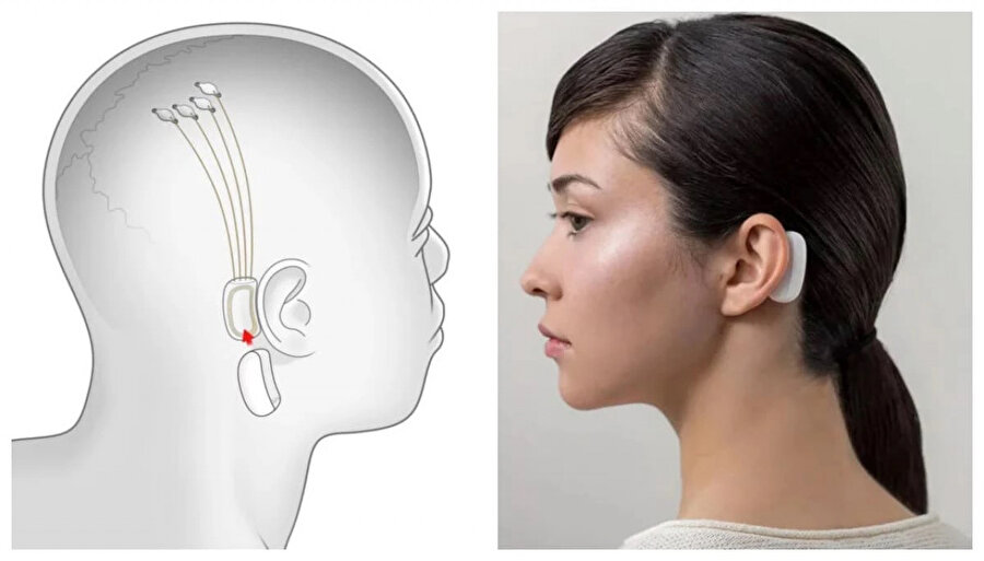 Neuralink