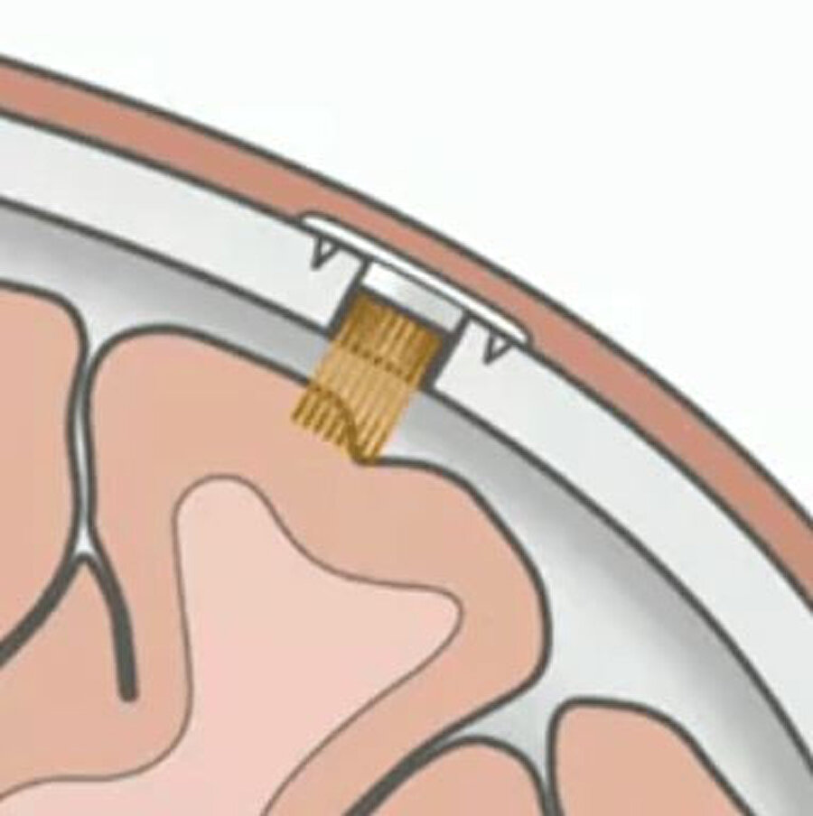 Neuralink'in asıl amacı insan beyni ve bilgisayarlar arasında bir köprü görevi görmek.