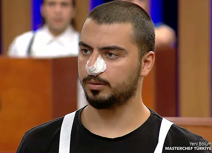 MasterChef'te Serhat'ın burnuna ne oldu?