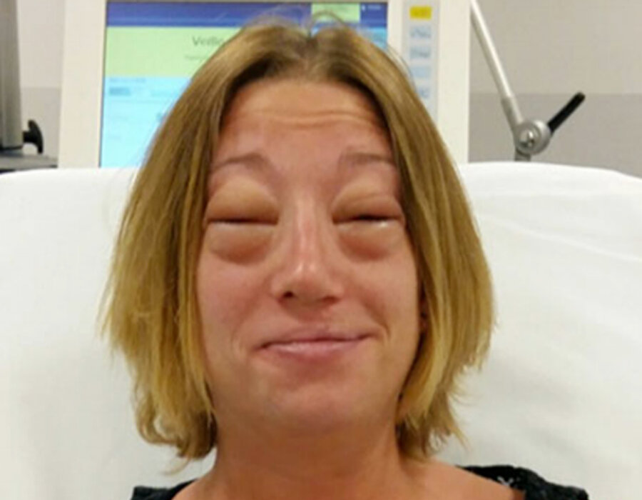 Litresi 100 lira: Eşek sütü içti bu hale geldi