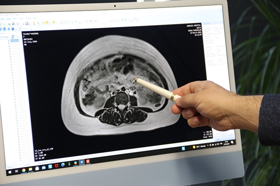 Yıllardır hamile gibi yaşıyordu, doktora gidince gerçek ortaya çıktı