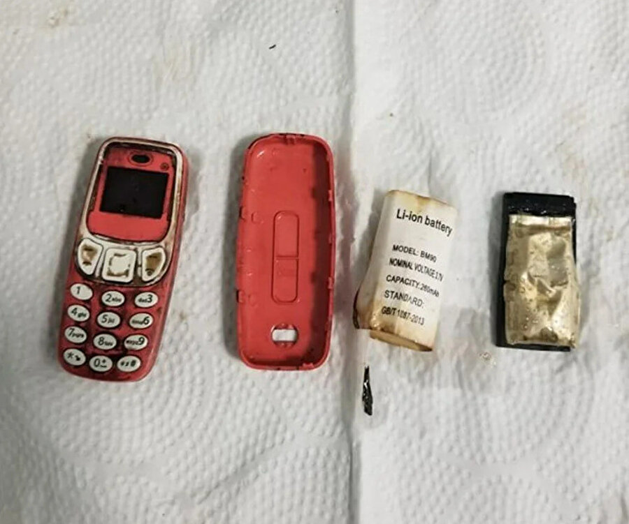 Şaşırtan ameliyat: Midesinden Nokia 3310 çıktı