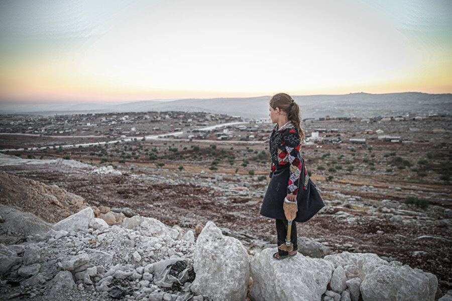 Esed'in saldırısında bacağını kaybeden İdlibli Yasemin.