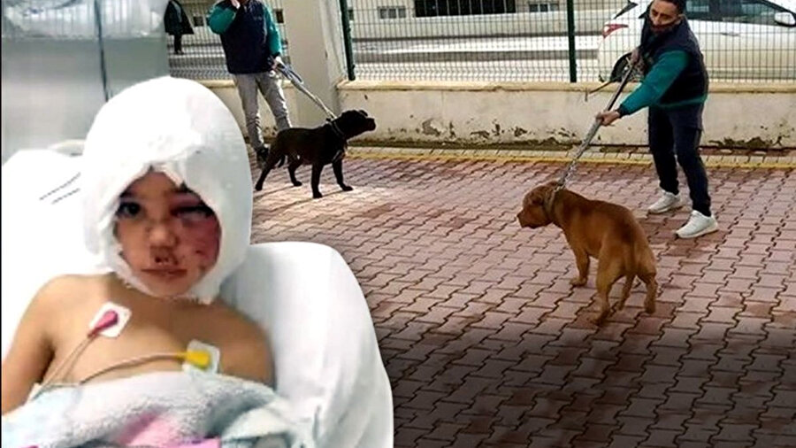 4 yaşındaki Asiye Ateş pitbull saldırısına uğradı