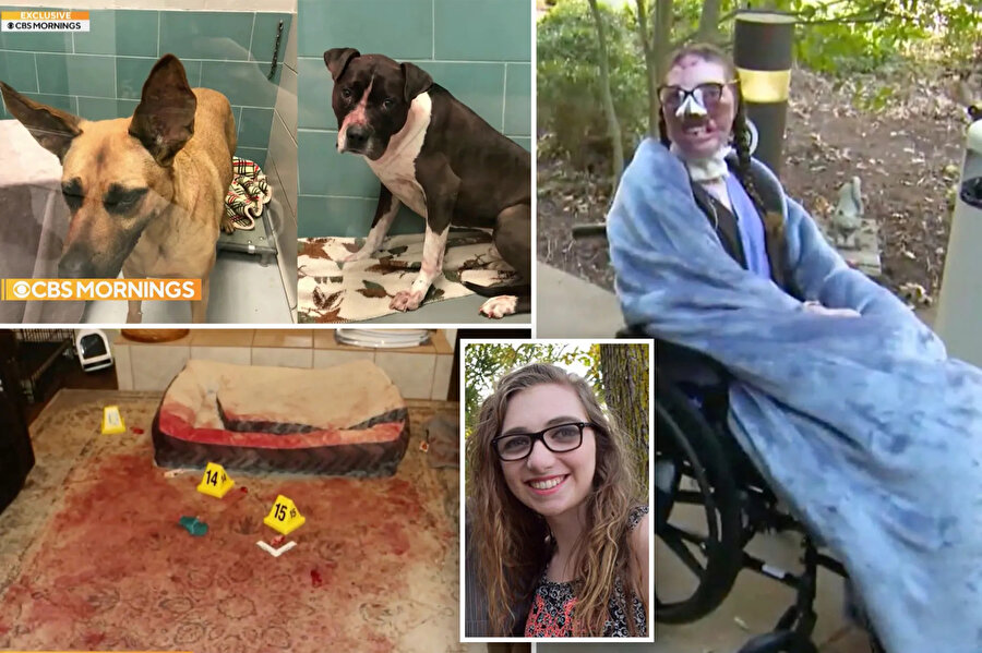 Jacqueline Durand, Shepard ve Boxer-Pitbull cinsi köpeklerin saldırısına uğradı