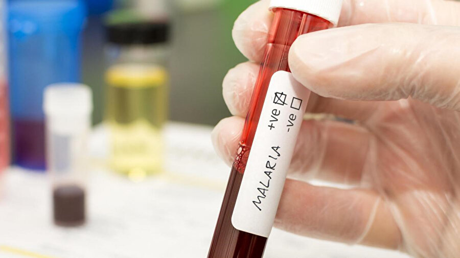 Gizemli hepatit alarmı