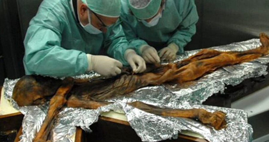 Ötzi