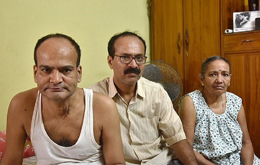 Takma dişlerini yutan adam, uzun süre yemek yiyemedi.