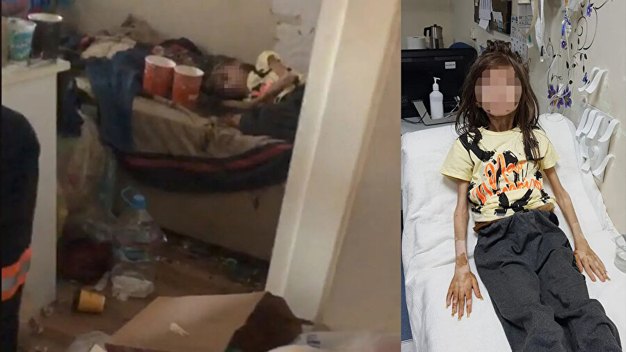 Prof. Dr Özkan açıkladı: Çöp evden çıkan çocuğun sağlık durumu nasıl?