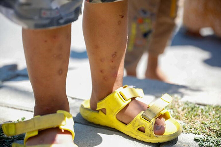  'Aedes' türü sivrisinek vatandaşların kabusu oldu