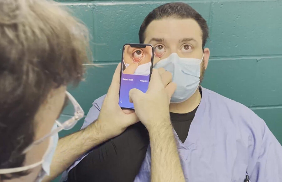 Türk hekimden çığır açacak buluş: Kansızlığı 'kan almadan' hastanın gözünden anlayan uygulama