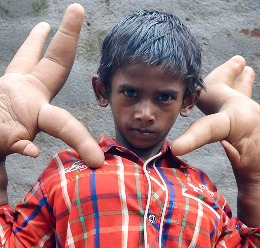 Kimse yanına yaklaşmıyor: Ellerini gören büyük şaşkınlık yaşıyor