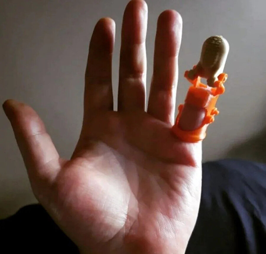 20 yıl önce kaybettiği parmağına üç boyutlu yazıcıyla kavuştu