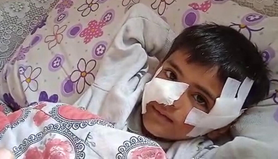 Köpeklerin saldırdığı çocuğa 40 dikiş atıldı