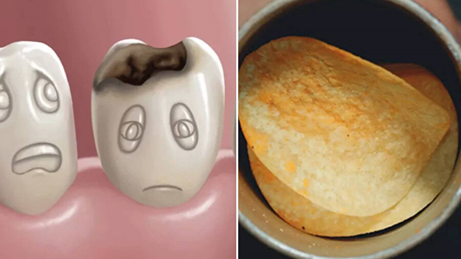 Diş çürüten gıdalar