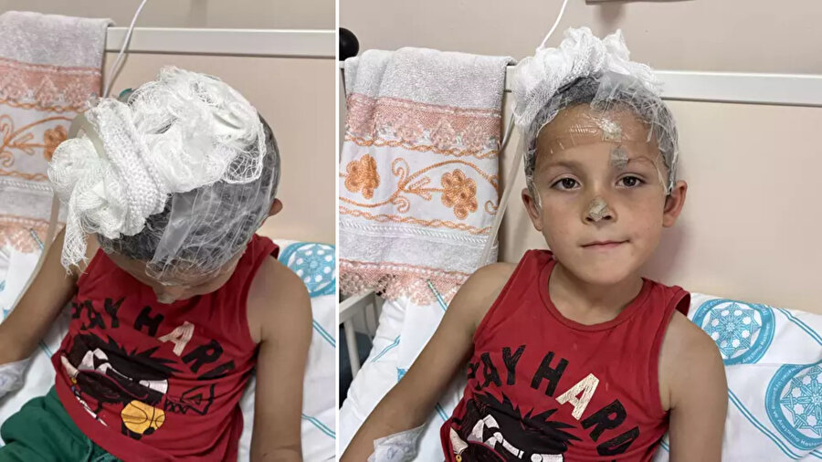 Sivas'ta başıboş köpeklerin saldırdığı 6 yaşındaki Emir 3 ameliyat geçirdi