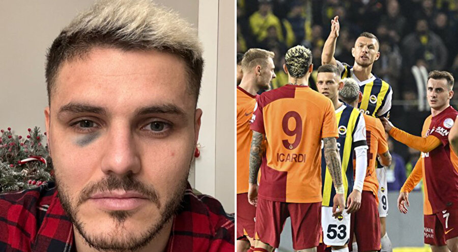 Dzeko - Icardi
