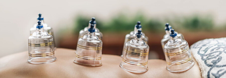 Bir hacamat hikayesi.