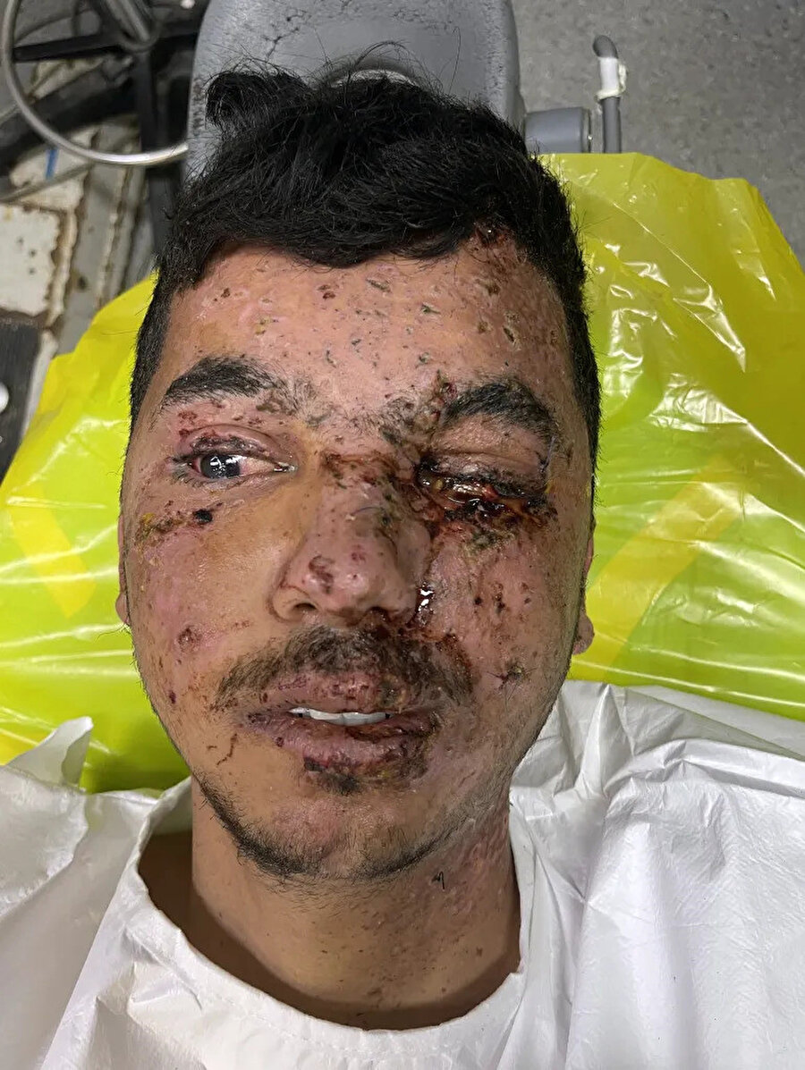 Gazze'deki 10 günlük tıbbî görevi sırasında Dr. Han, İsrail saldırılarında yaralanan çok sayıda çocuk ve yetişkinin gözlerini aldığı ameliyatlar yaptı. Han, bu yaygın yaralanmaları, "Gazze’nin şarapnel yüzü" olarak tanımlıyor.