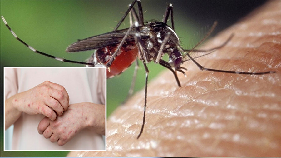 İstanbul'da Asya kaplan sivrisineği giderek yayılıyor.