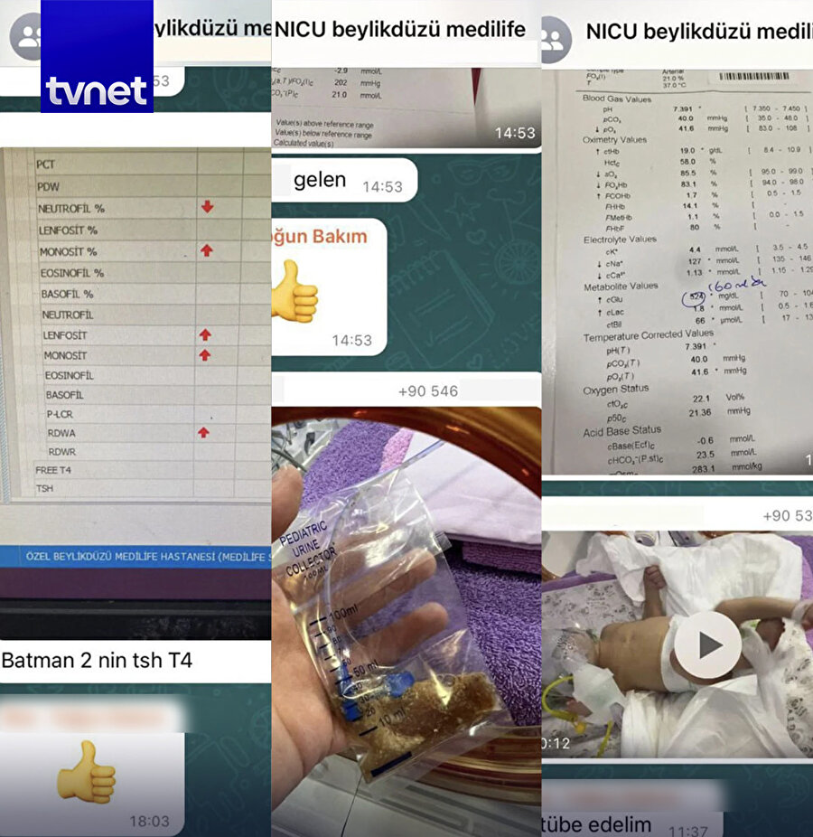 "Kestim nefesini haberiniz olsun"