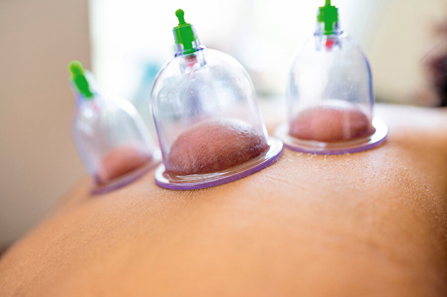 İbn Sînâ’nın da belirttiği gibi en doğru hacamat zaman dolunay günleridir ve hacamat bugünlerde yapıldığında insanı dinginleştirir, sakinleştirir.