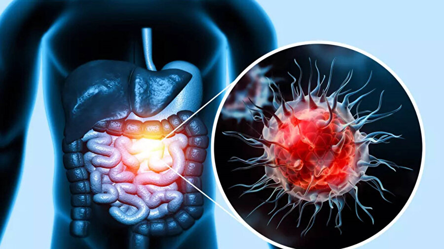 Uzmanından kolon kanseri hakkında önemli uyarılar: 50 yaş üstü daha riskli