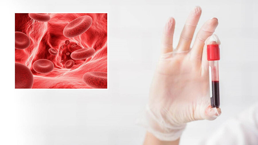 Kansere en çok yakalanan kan grubu hangisi? Araştırmadan çarpıcı sonuç