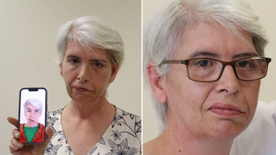 Yıllardır gözleri açık uyuyordu: 24 ayar altınla yapılan tedavi şifa oldu