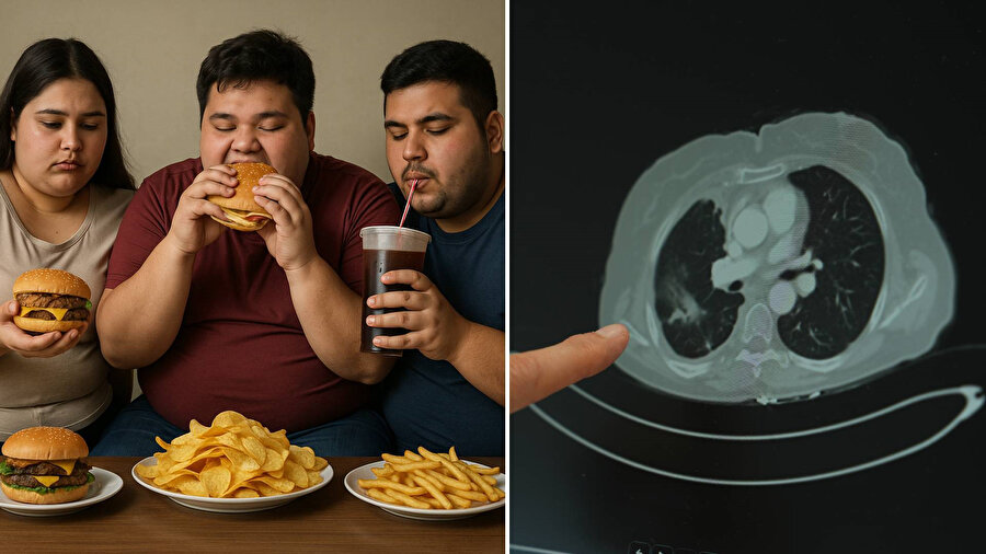 ​Gençlerde kanser vakaları artıyor: Batı diyeti Türk gençleri vurdu