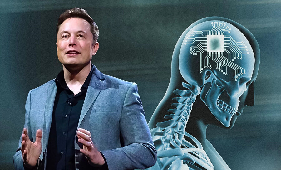 Elon Musk'ın beyin çipi Neuralink'e yeni rakip: İlk insan testi gerçekleştirildi