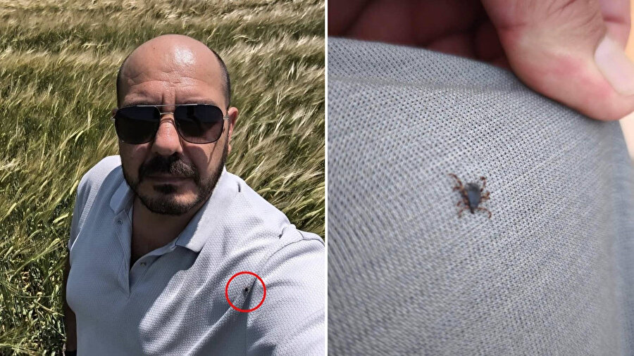 Çektiği 'selfie' hayatını kurtardı: Fotoğrafa baktığında üzerindeki keneyi fark etti