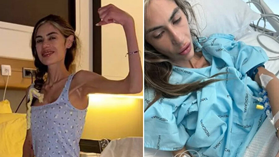 Sosyal medya fenomeni Nihal Candan 23 kiloya düştü: Yoğun bakıma alındı