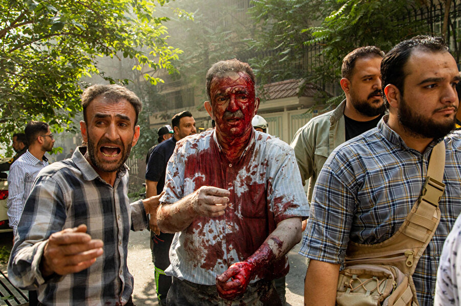 İranlılar, Tahran şehir merkezindeki Keshavarz Bulvarı'nda gerçekleşen İsrail saldırısında yaralanan bir adamla ilgileniyor.