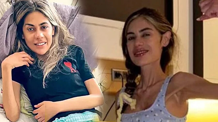 Nihal Candan'ın hastalığı neydi? Anoreksiya Nervoza ve Refeeding sendromu nedir? İşte ölümünün perde arkası