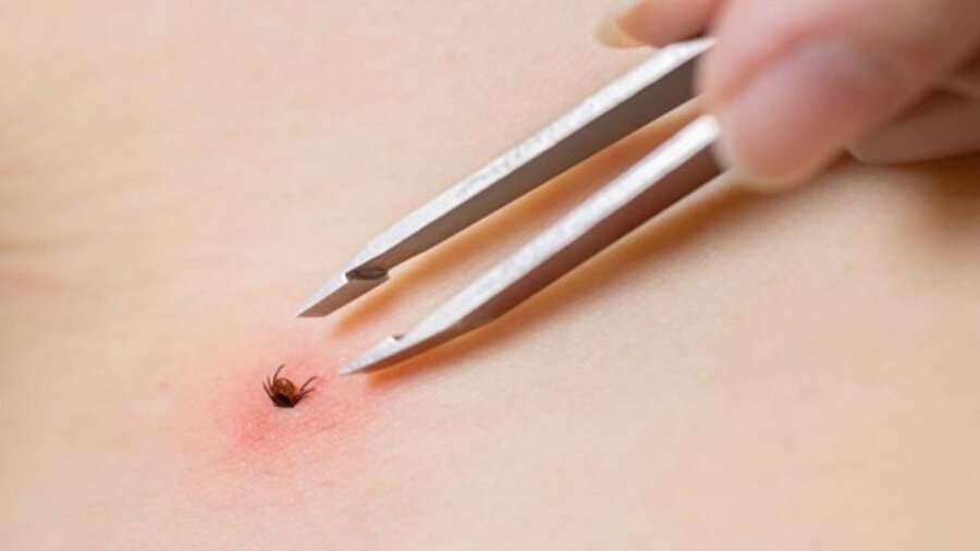 Kırım-Kongo Kanamalı Ateşi (KKKA)