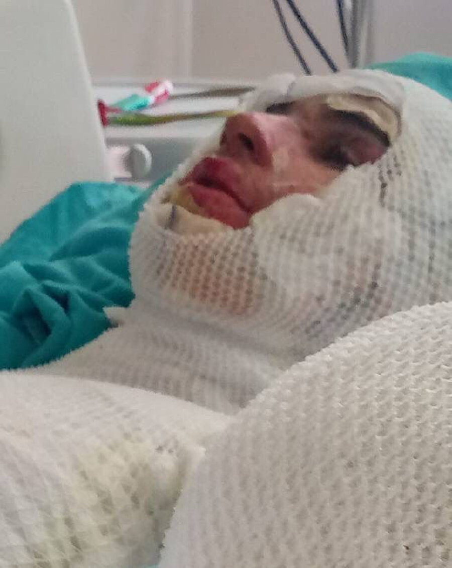 Yaralı genç yoğun bakımda