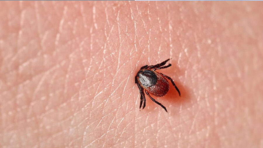 ​Uzmandan kritik uyarı: Grip sandığınız ölümcül kene ısırığı olabilir