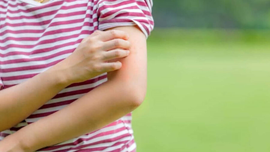 Her evde var: Sineklerden kurtulmak için doğal yöntem