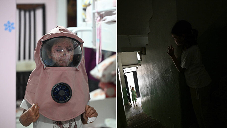 Karanlık odasında hayata tutunuyor: Güneşe hasret küçük Cemile'nin zorlu mücadelesi