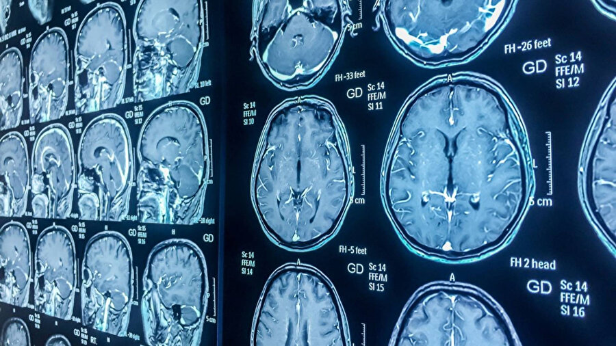 ​Tıpta çığır açan proje: 100 bin kişi üzerinde yapılan incelemeyle beden haritası çıkarıldı