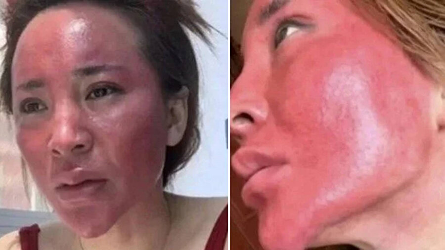 22 yıl boyunca makyajını temizlemedi: Çinli kadının yüzü tanınmaz hale geldi