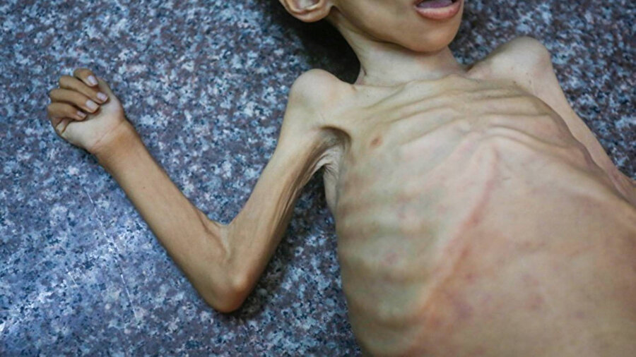 Gazze'de 4 yaşındaki bir kız çocuğu yardımların kısıtlanması sonucu hayatını kaybetti